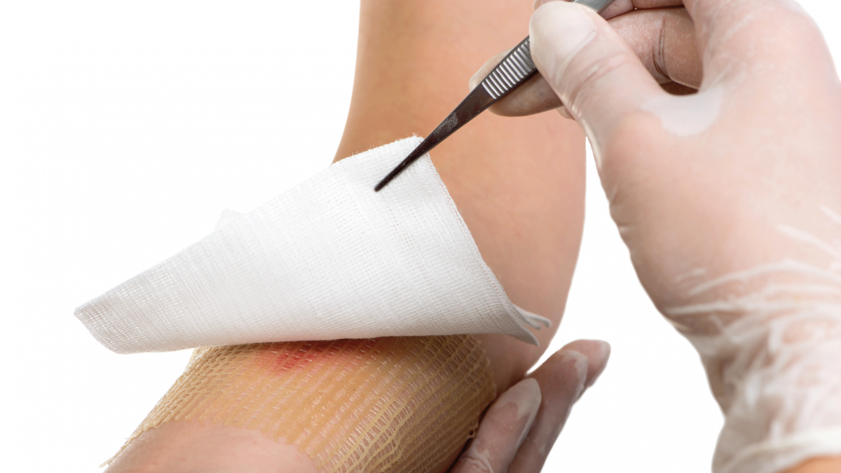 Curación de heridas | TotalCare - Servicios Integrales en Salud